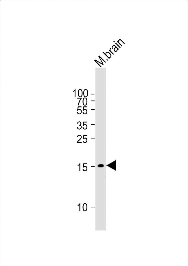 GABARAP Antibody in Western Blot (WB)