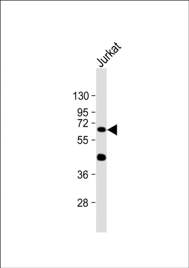 CYP1A1 Antibody in Western Blot (WB)