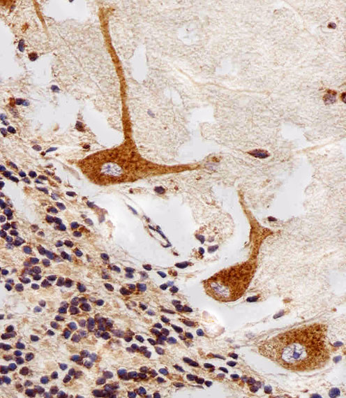 PPT1 Antibody in Immunohistochemistry (Paraffin) (IHC (P))