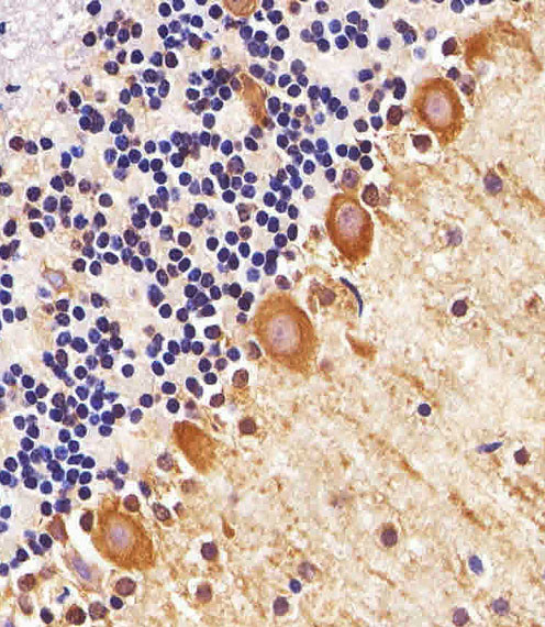 PPT1 Antibody in Immunohistochemistry (Paraffin) (IHC (P))