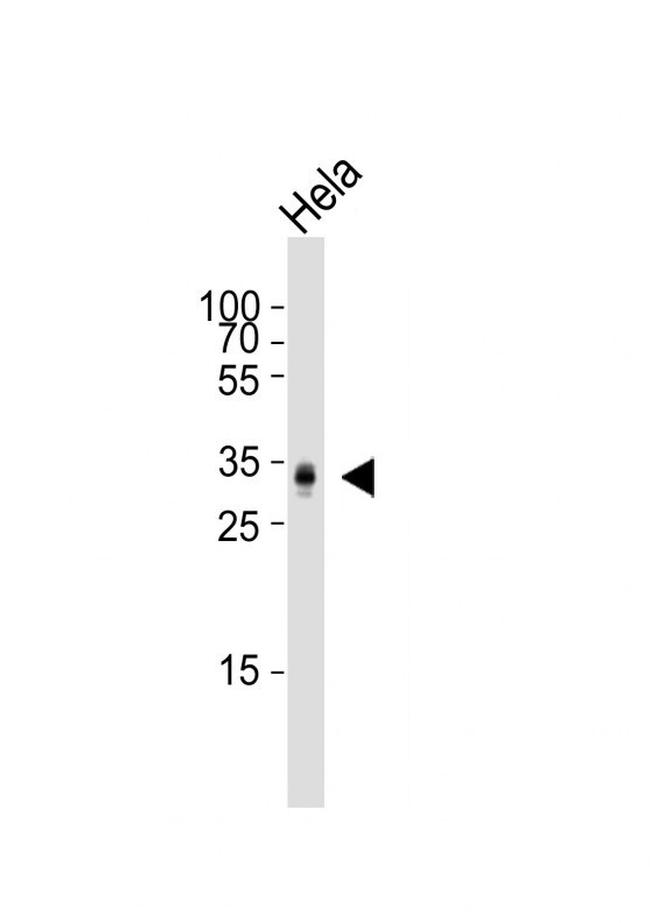 PPT1 Antibody in Western Blot (WB)