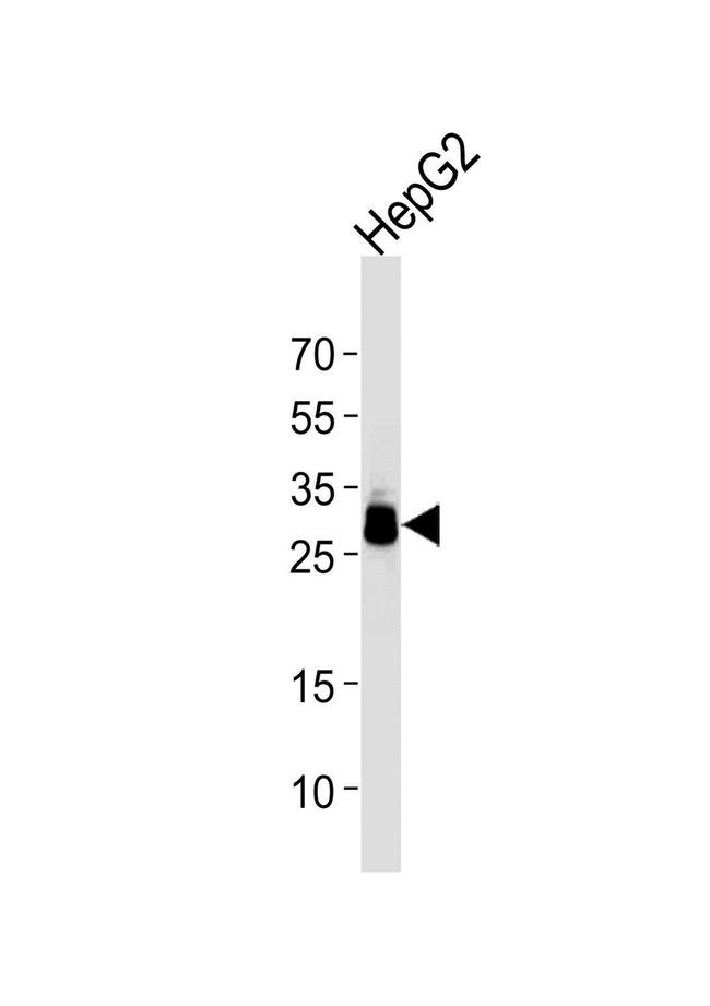 PPT1 Antibody in Western Blot (WB)