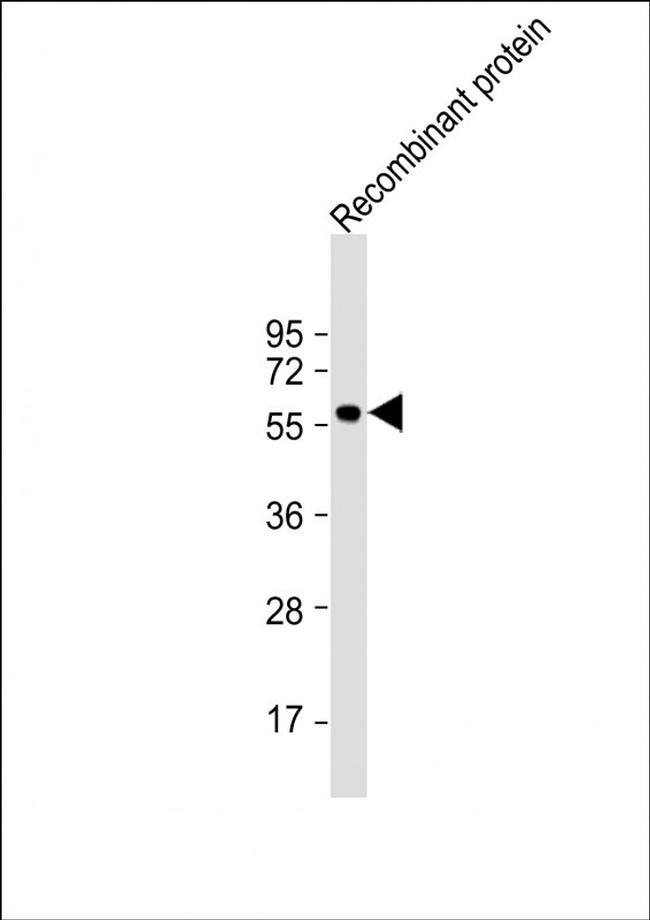 KLF4 Antibody in Western Blot (WB)