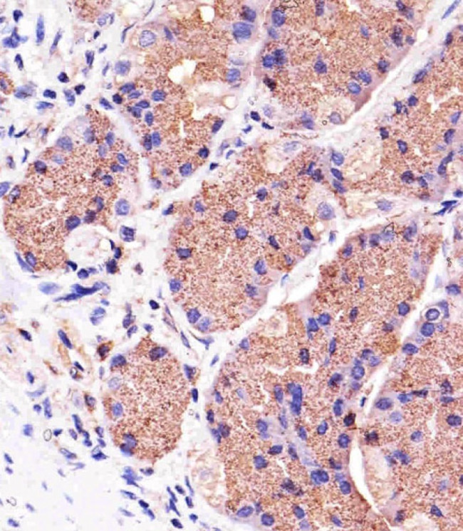 PINK1 Antibody in Immunohistochemistry (Paraffin) (IHC (P))