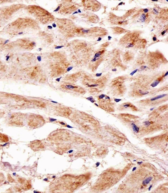 PINK1 Antibody in Immunohistochemistry (Paraffin) (IHC (P))