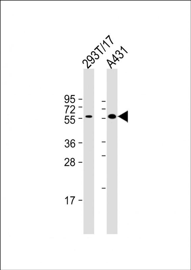 PINK1 Antibody in Western Blot (WB)