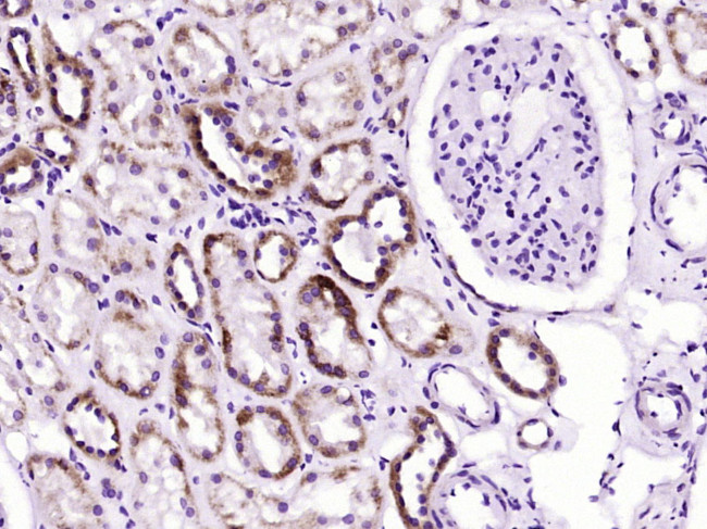 SOD2 Antibody in Immunohistochemistry (Paraffin) (IHC (P))