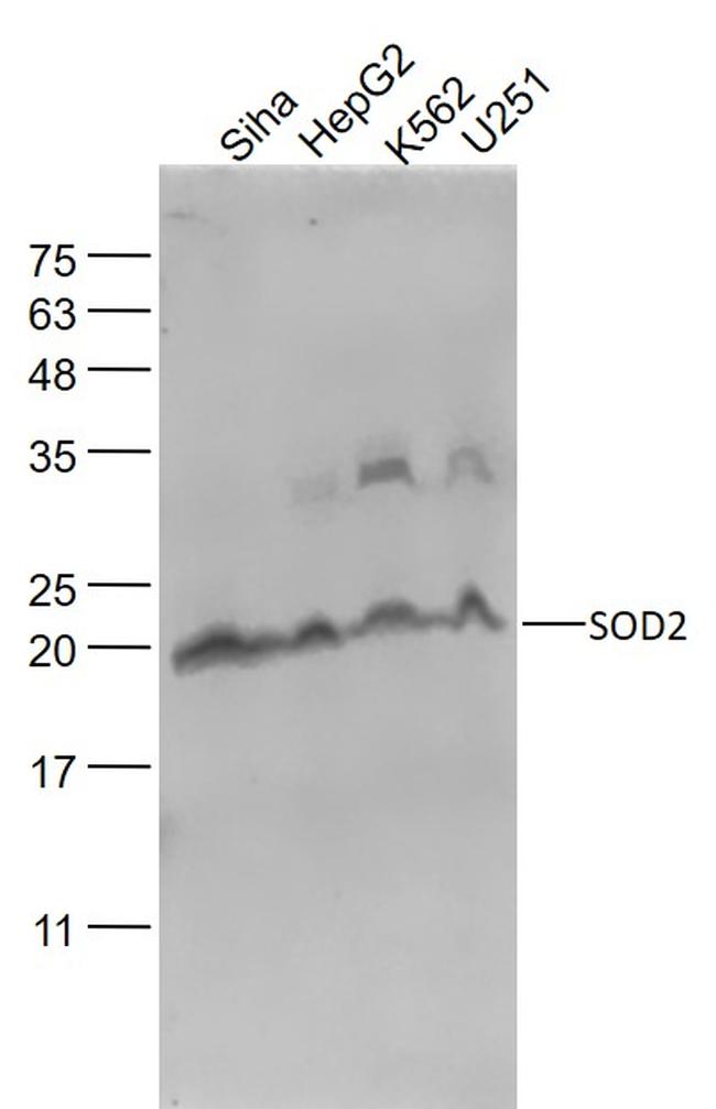 SOD2 Antibody in Western Blot (WB)