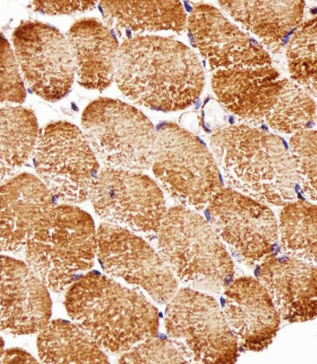 RPTOR Antibody in Immunohistochemistry (Paraffin) (IHC (P))