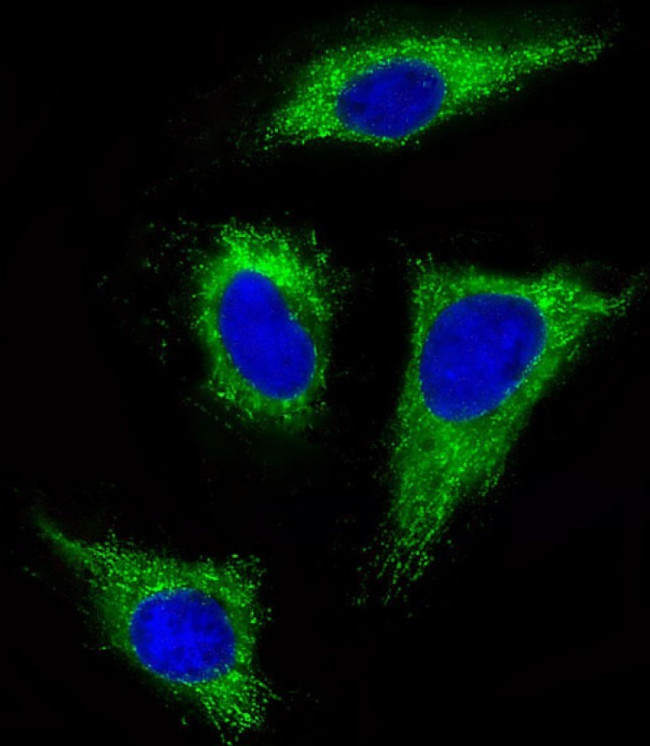 FGFR1 Antibody in Immunocytochemistry (ICC/IF)