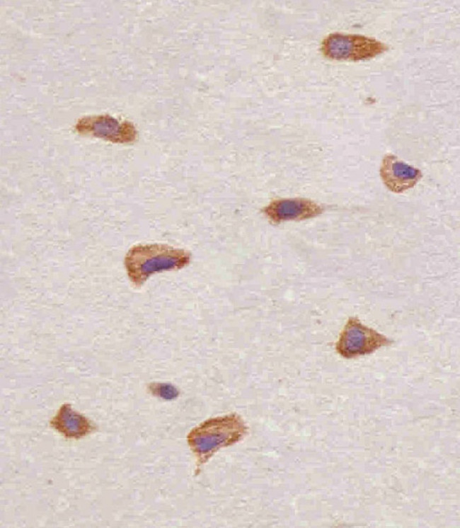 FGFR1 Antibody in Immunohistochemistry (Paraffin) (IHC (P))