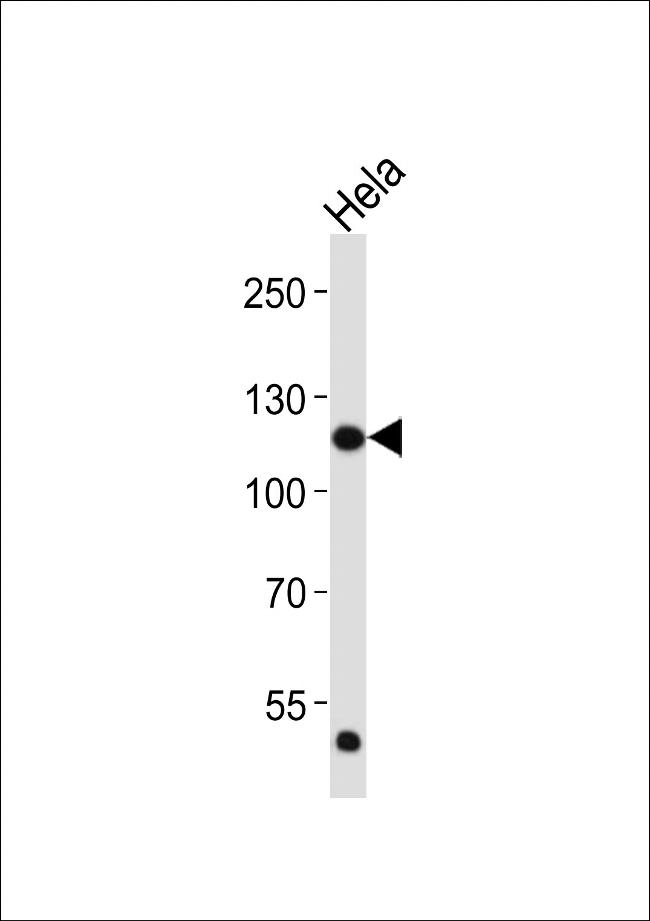 FGFR1 Antibody in Western Blot (WB)