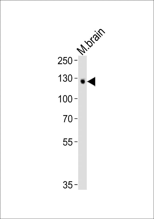 Tyro3 Antibody in Western Blot (WB)