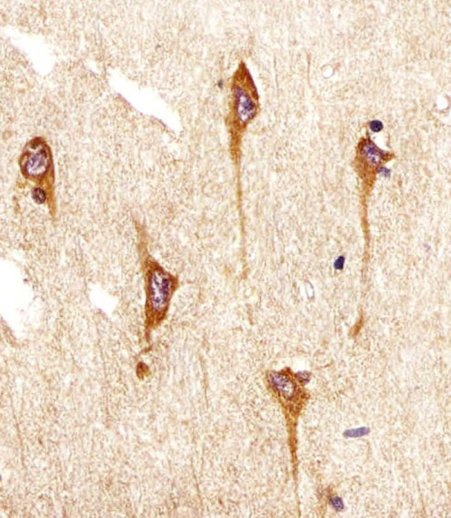 NTRK2 Antibody in Immunohistochemistry (Paraffin) (IHC (P))