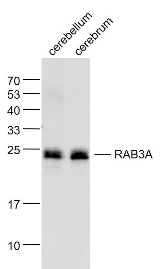 RAB3A Antibody in Western Blot (WB)