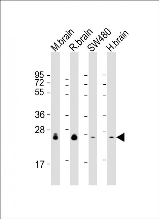 RAB3B Antibody in Western Blot (WB)