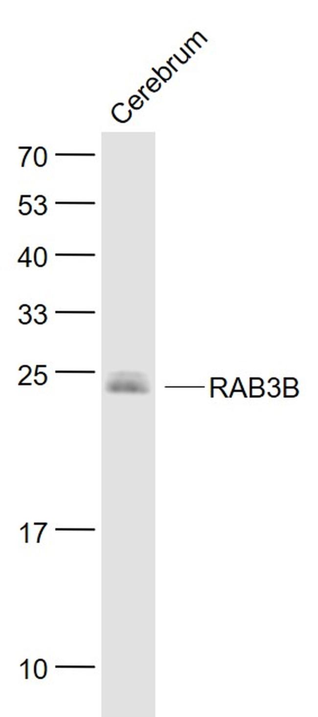 RAB3B Antibody in Western Blot (WB)