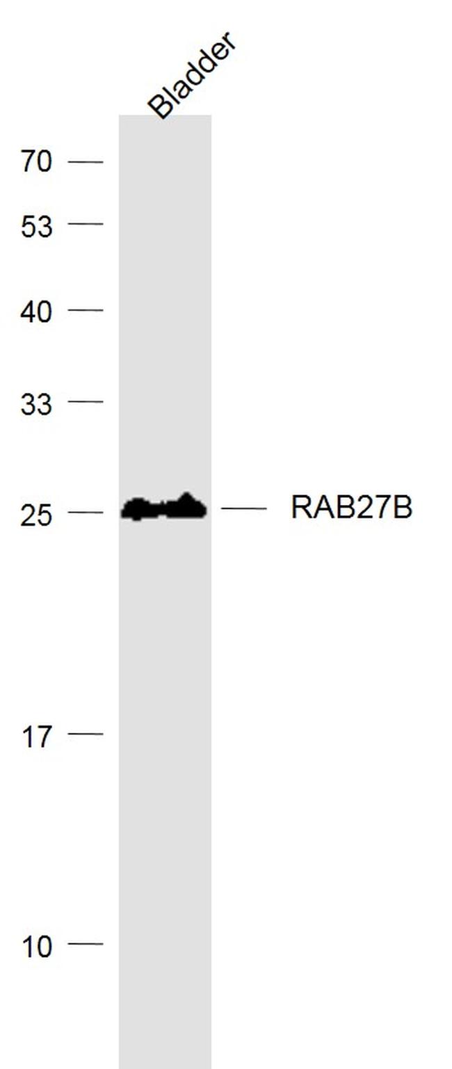 RAB27B Antibody in Western Blot (WB)