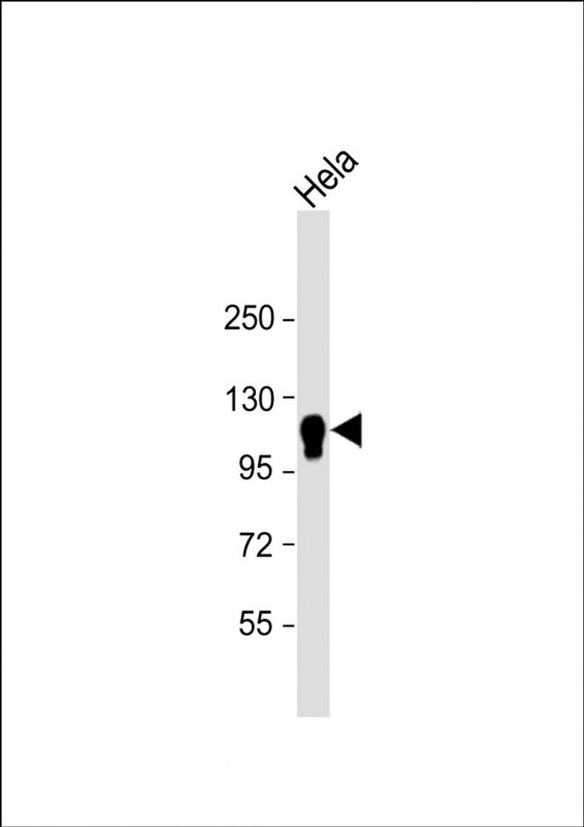 CYLD Antibody in Western Blot (WB)