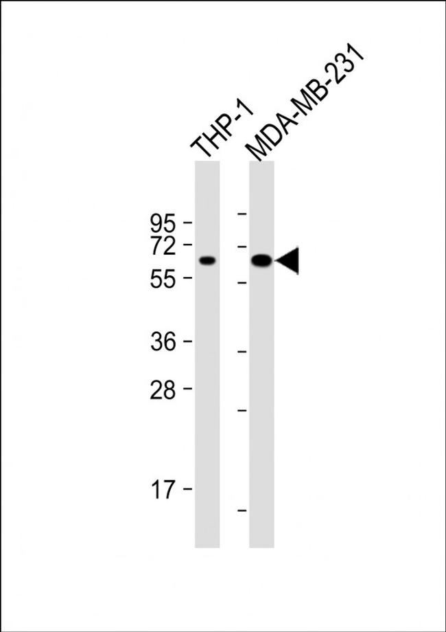 MB21D1 Antibody in Western Blot (WB)