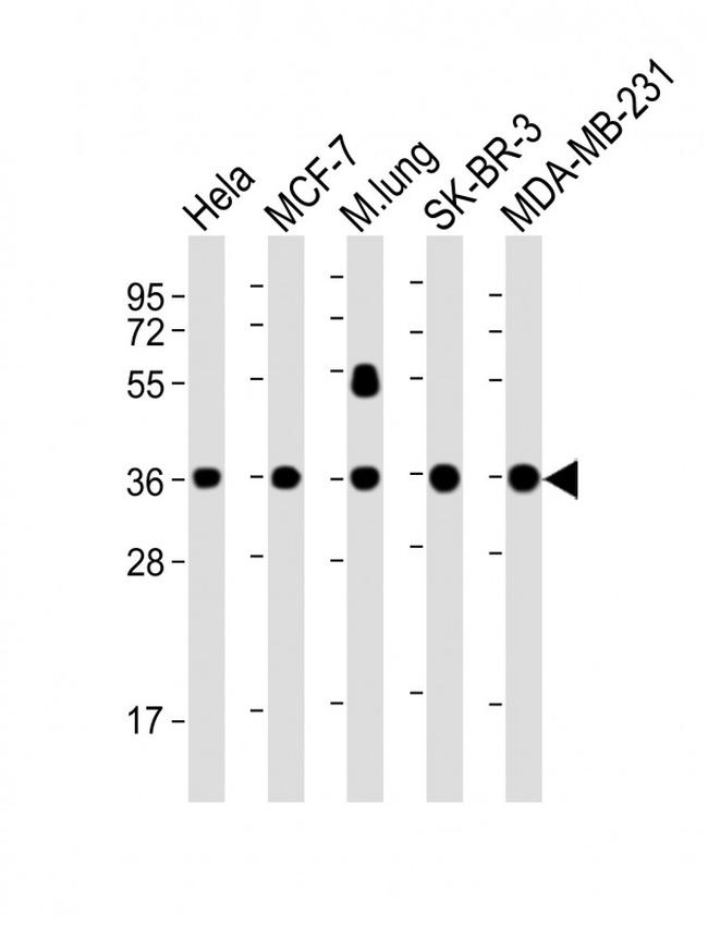 WNT4 Antibody in Western Blot (WB)