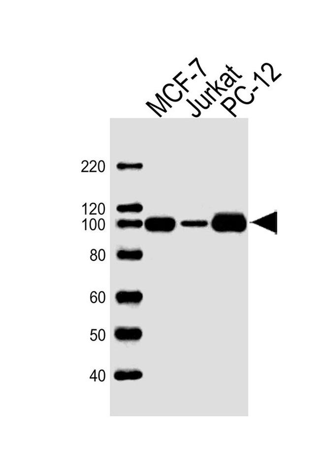 TOP1 Antibody in Western Blot (WB)