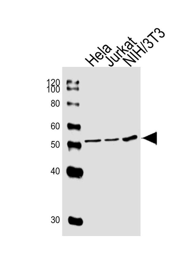 PPARA Antibody in Western Blot (WB)