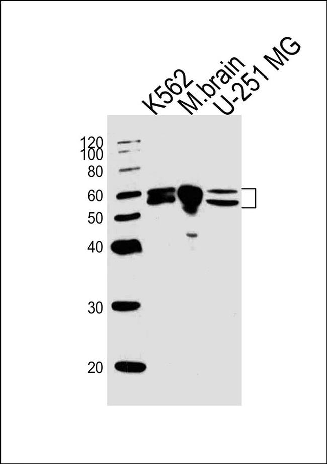 BAIAP2 Antibody in Western Blot (WB)