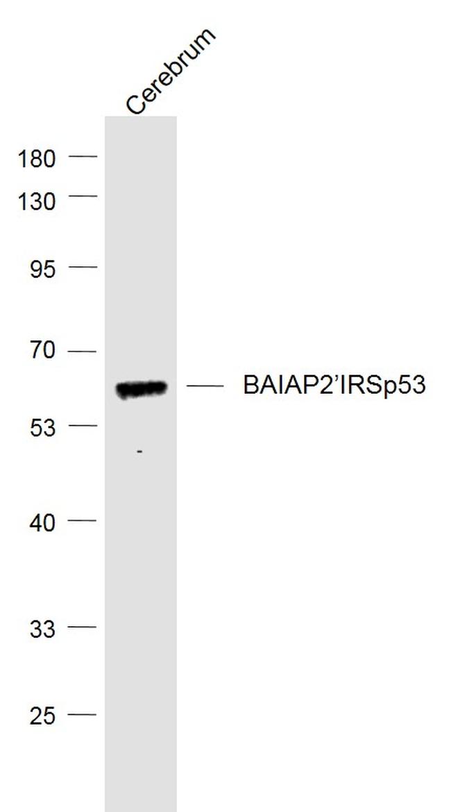 BAIAP2 Antibody in Western Blot (WB)