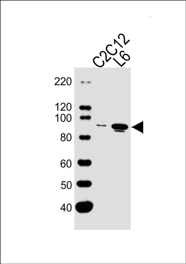 Musk Antibody in Western Blot (WB)