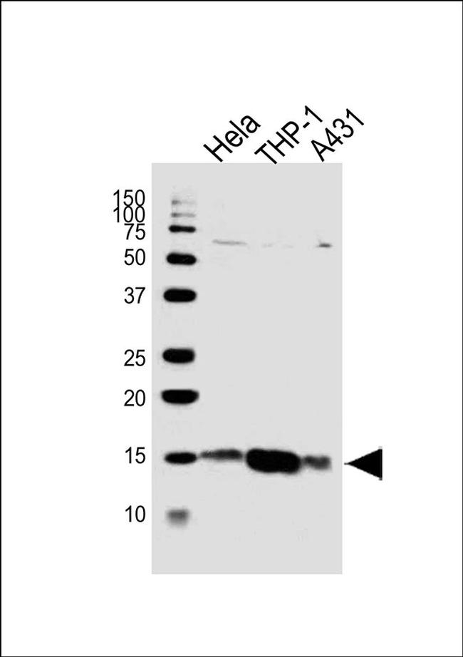 VAMP8 Antibody in Western Blot (WB)