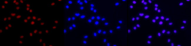 HDAC2 Antibody in Immunocytochemistry (ICC/IF)