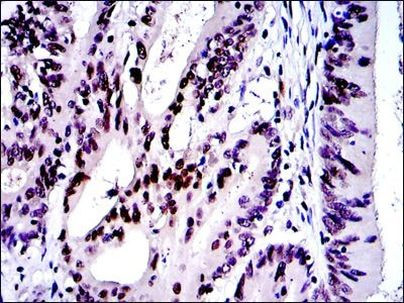 c-Jun Antibody in Immunohistochemistry (Paraffin) (IHC (P))