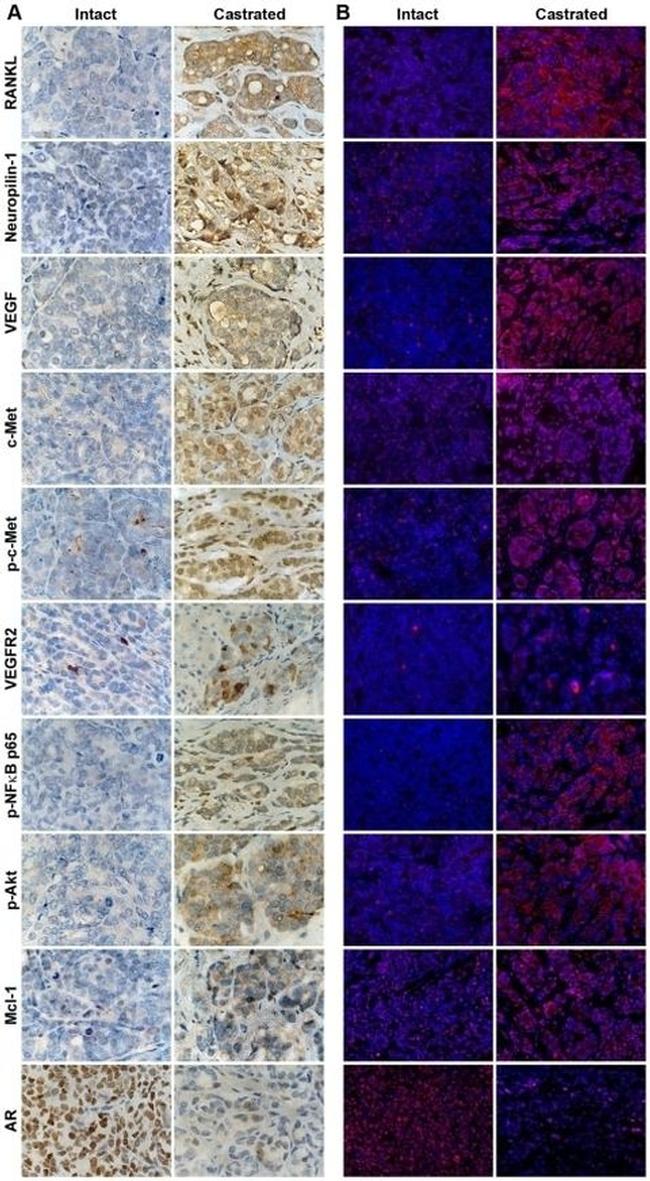 Phospho-c-Met (Tyr1230, Tyr1234, Tyr1235) Antibody in Immunohistochemistry (IHC)