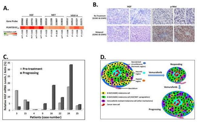 Phospho-c-Met (Tyr1003) Antibody in Immunohistochemistry (Paraffin) (IHC (P))