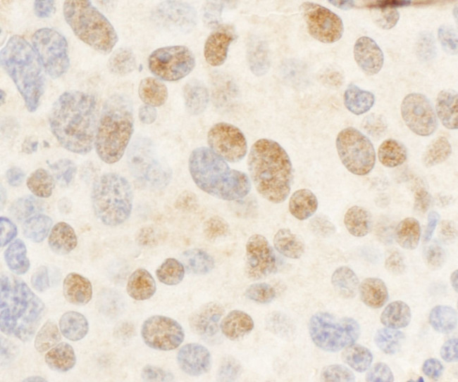 c-Myb Antibody in Immunohistochemistry (IHC)