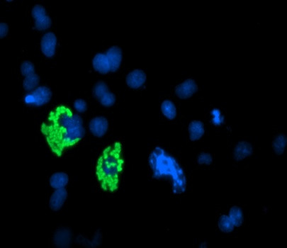 c-Myc Antibody in Immunocytochemistry (ICC/IF)