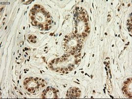 c-Myc Antibody in Immunohistochemistry (Paraffin) (IHC (P))