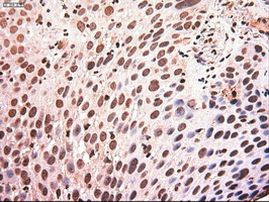 c-Myc Antibody in Immunohistochemistry (Paraffin) (IHC (P))