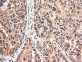 c-Myc Antibody in Immunohistochemistry (Paraffin) (IHC (P))