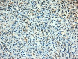 c-Myc Antibody in Immunohistochemistry (Paraffin) (IHC (P))