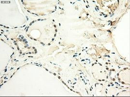 c-Myc Antibody in Immunohistochemistry (Paraffin) (IHC (P))