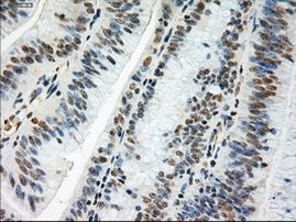 c-Myc Antibody in Immunohistochemistry (Paraffin) (IHC (P))