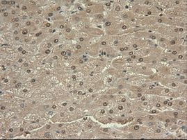 c-Myc Antibody in Immunohistochemistry (Paraffin) (IHC (P))