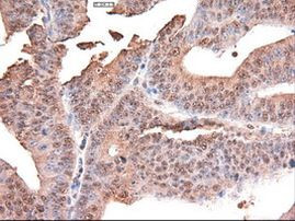 c-Myc Antibody in Immunohistochemistry (Paraffin) (IHC (P))