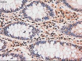 c-Myc Antibody in Immunohistochemistry (Paraffin) (IHC (P))