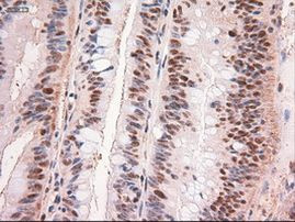 c-Myc Antibody in Immunohistochemistry (Paraffin) (IHC (P))