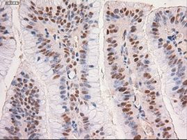 c-Myc Antibody in Immunohistochemistry (Paraffin) (IHC (P))