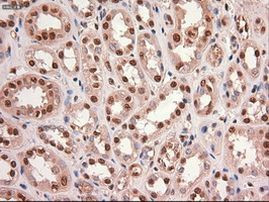 c-Myc Antibody in Immunohistochemistry (Paraffin) (IHC (P))