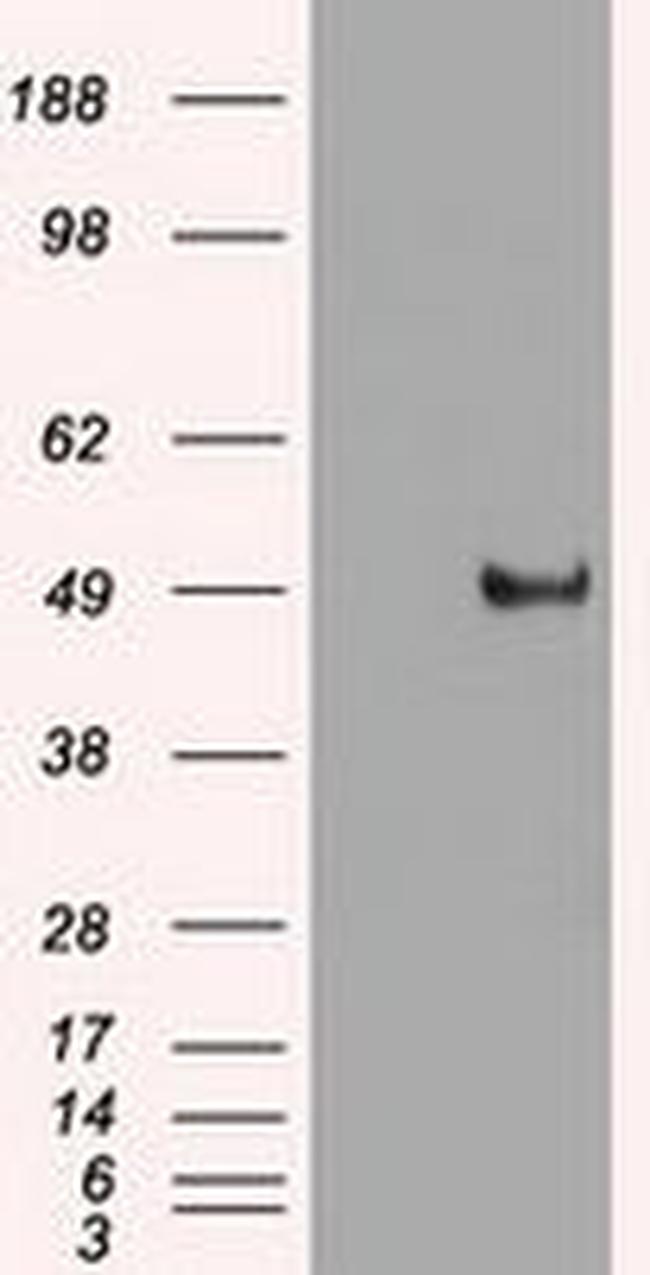 c-Myc Antibody in Western Blot (WB)